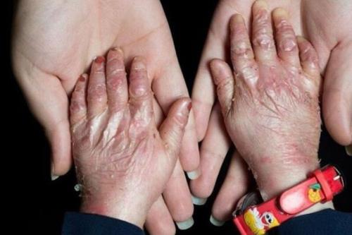 آتش تحریم، همچنان بر بال پروانه ای ها